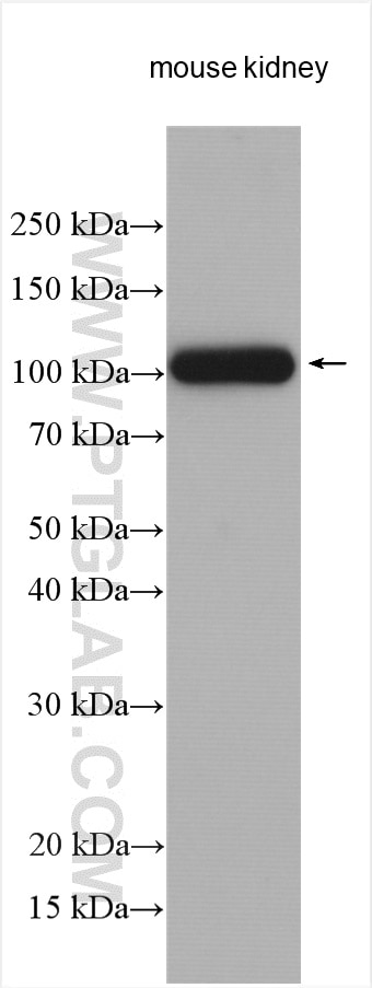 Western Blot (WB) analysis of various lysates using ATP6V0A4 Polyclonal antibody (21570-1-AP)