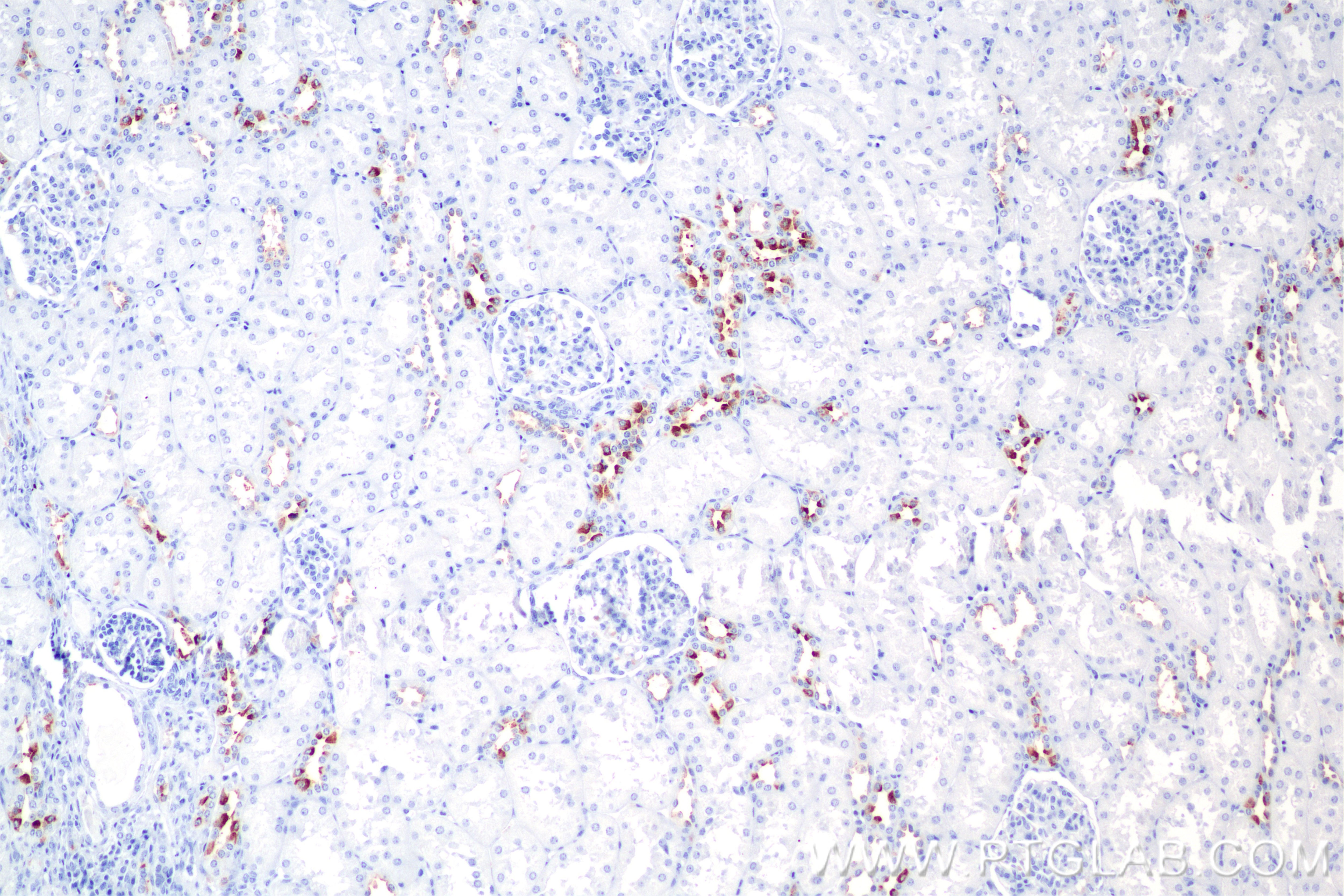 Immunohistochemistry (IHC) staining of human kidney tissue using ATP6V0A4 Recombinant antibody (86321-1-RR)