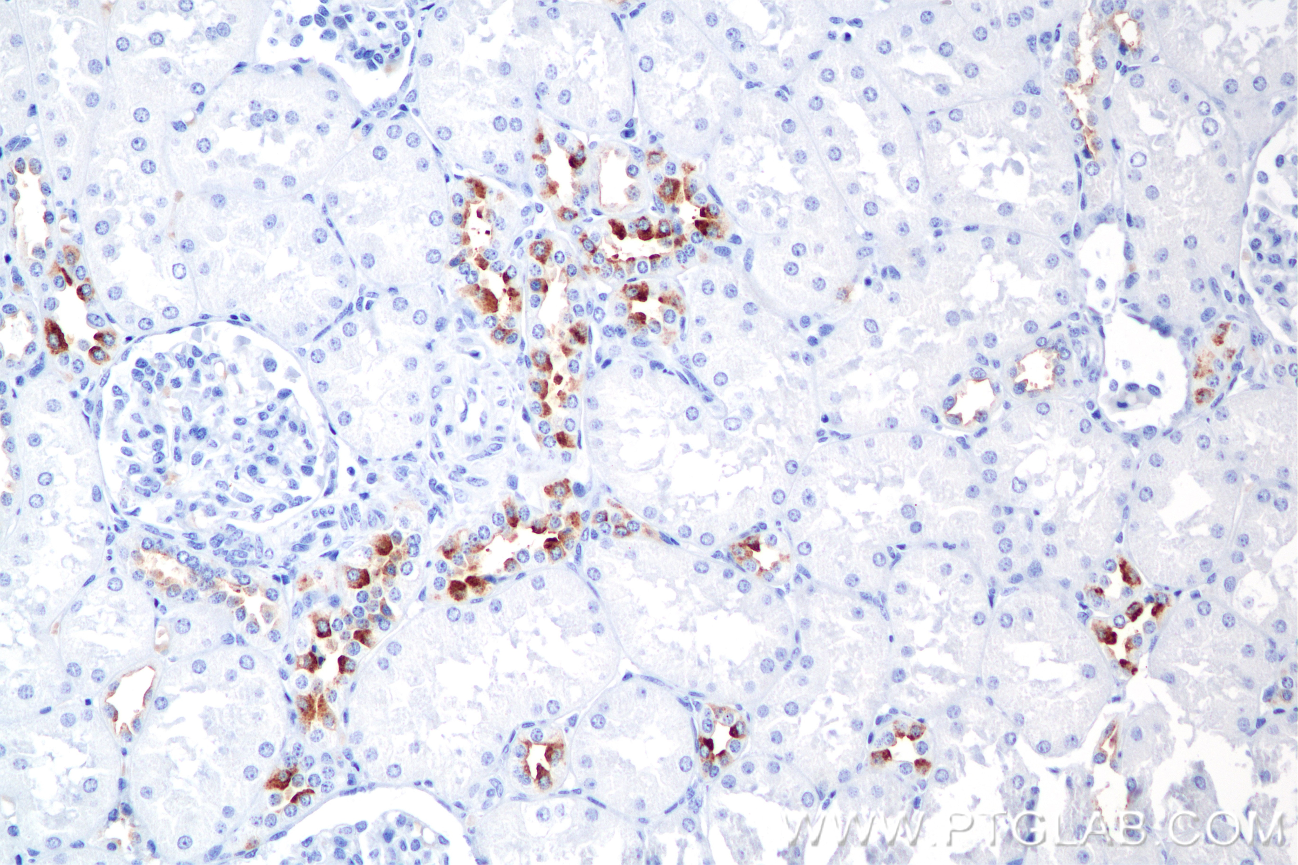 Immunohistochemistry (IHC) staining of human kidney tissue using ATP6V0A4 Recombinant antibody (86321-1-RR)