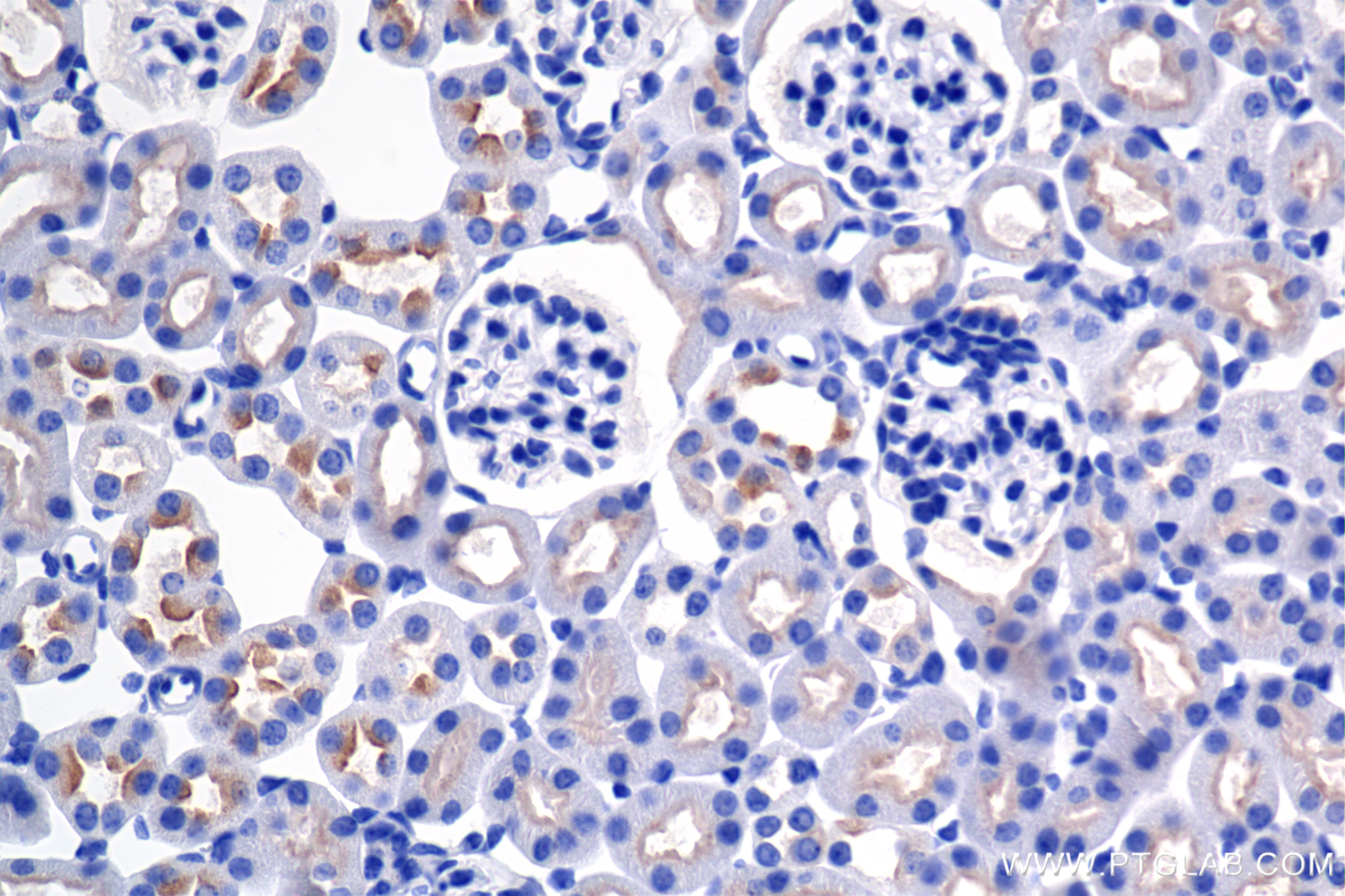 Immunohistochemistry (IHC) staining of mouse kidney tissue using ATP6V0A4 Recombinant monoclonal antibody (86321-1-RR)