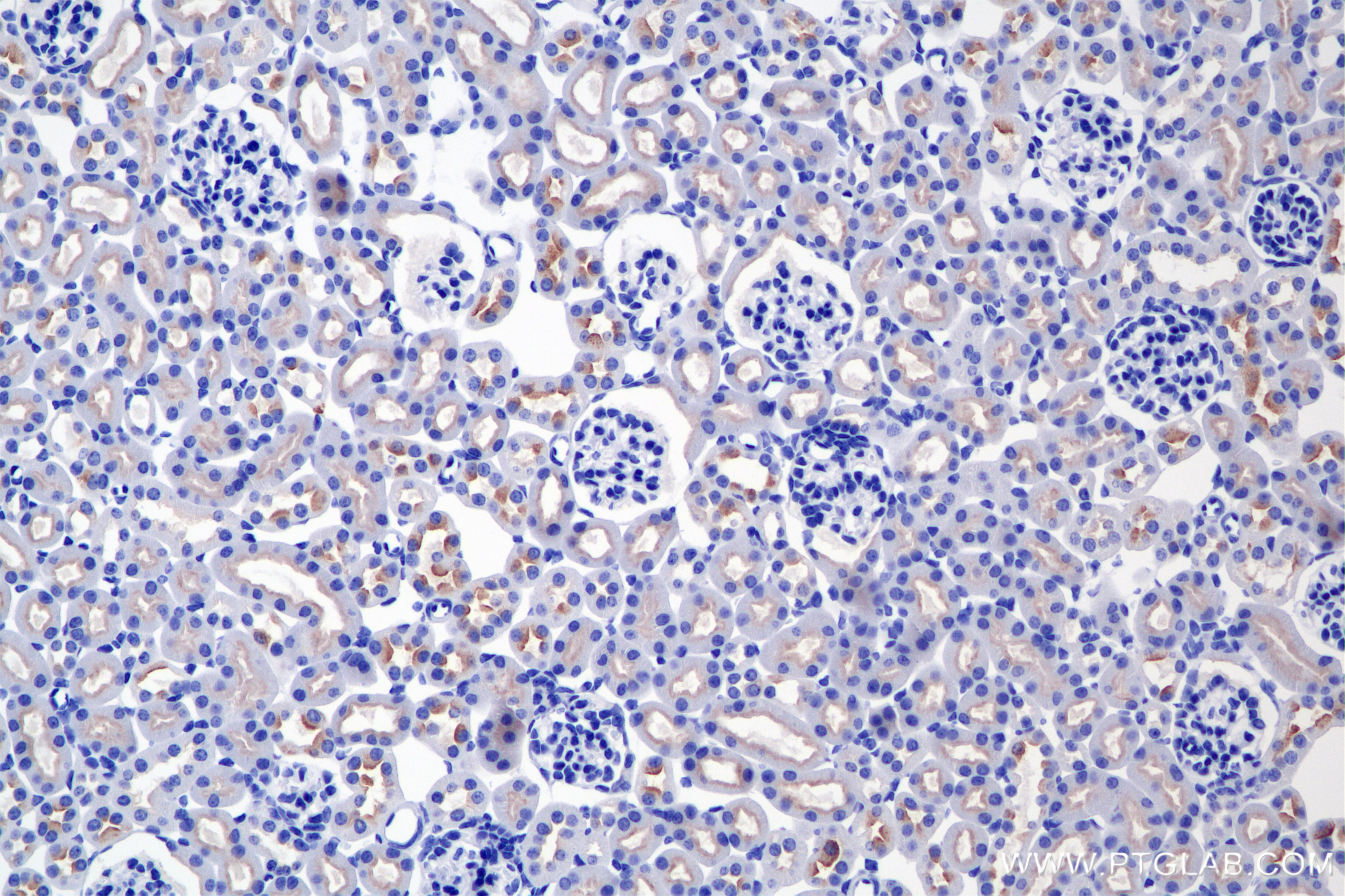 Immunohistochemistry (IHC) staining of mouse kidney tissue using ATP6V0A4 Recombinant monoclonal antibody (86321-1-RR)