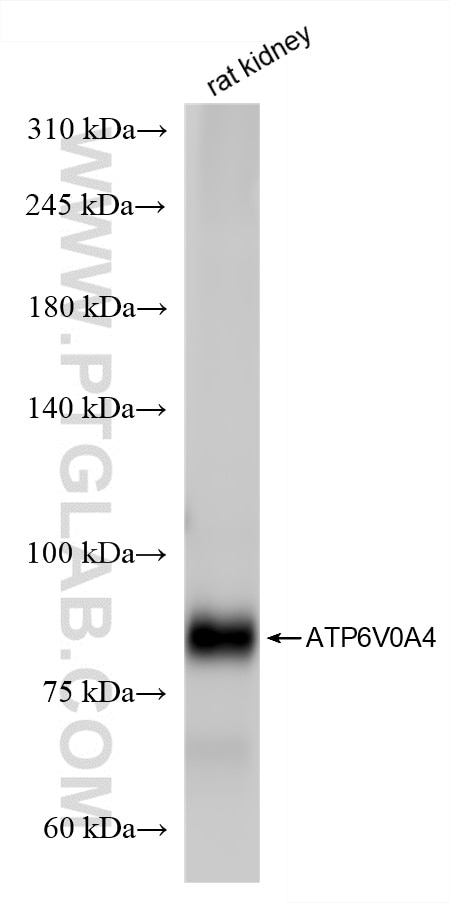 Western Blot (WB) analysis of rat kidney tissue using ATP6V0A4 Recombinant antibody (86321-1-RR)