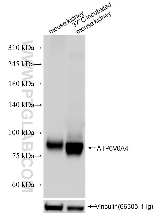 Western Blot (WB) analysis of various lysates using ATP6V0A4 Recombinant antibody (86321-1-RR)