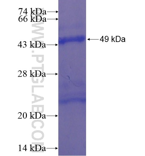 ATP6V0A4 fusion protein Ag16095 SDS-PAGE
