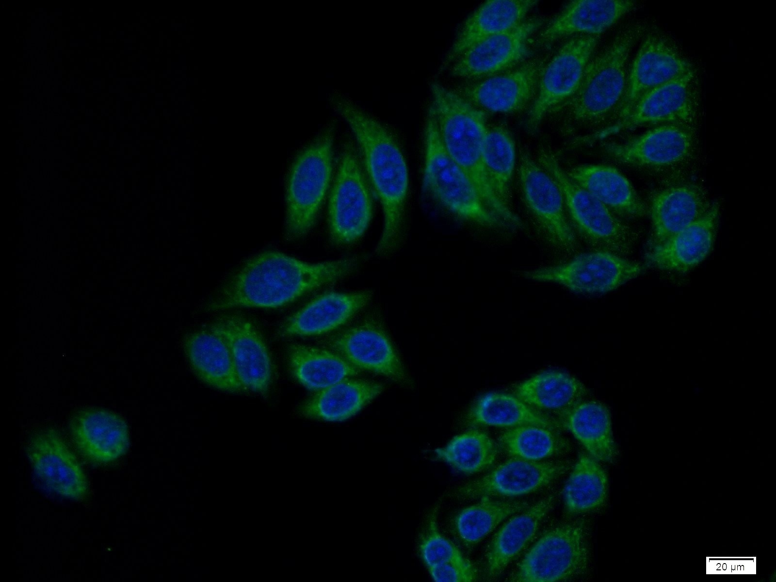 Immunofluorescence (IF) / fluorescent staining of HeLa cells using ATP6V0D1 Polyclonal antibody (18274-1-AP)