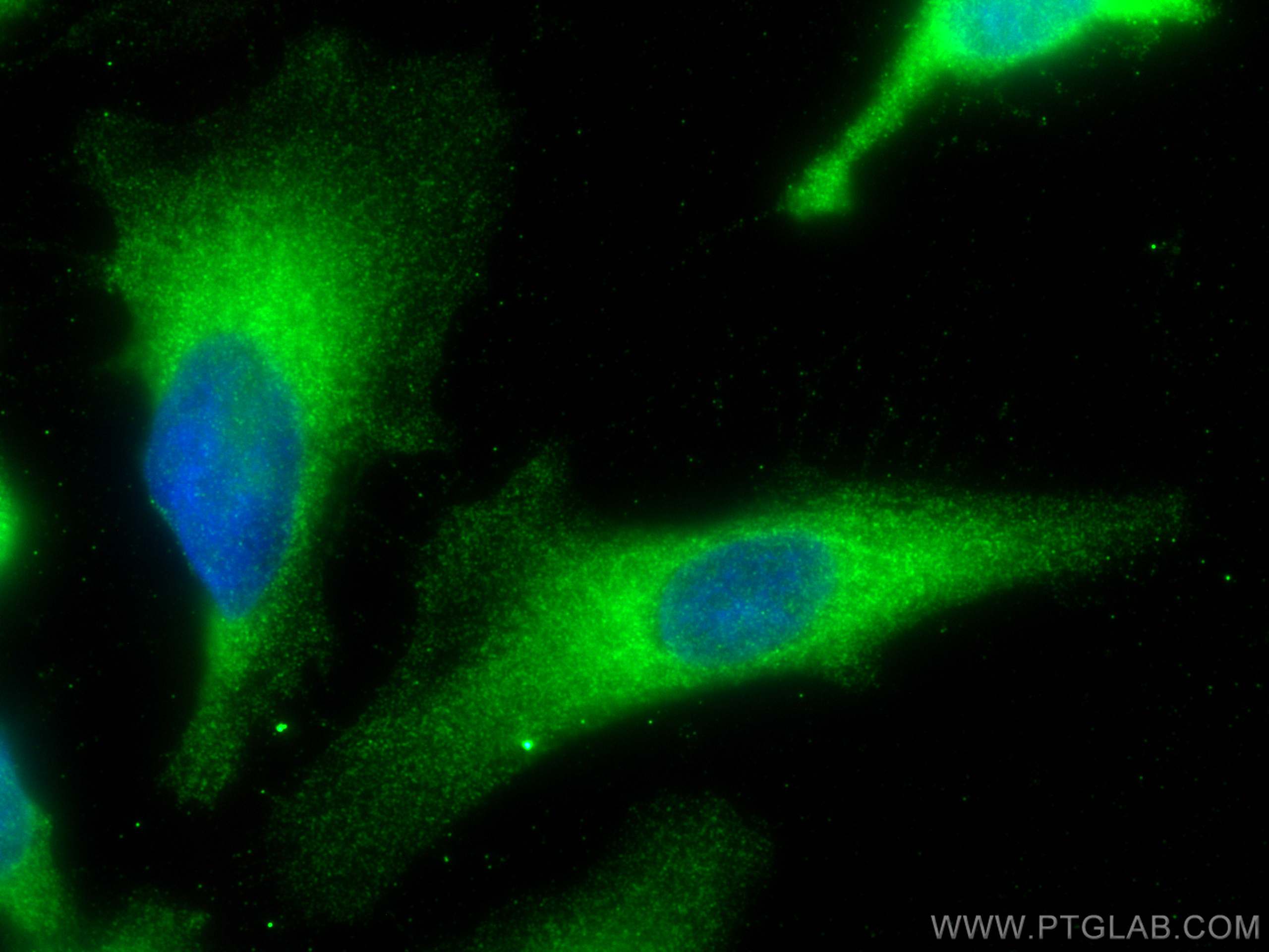 Immunofluorescence (IF) / fluorescent staining of HeLa cells using ATP6V0D1 Polyclonal antibody (18274-1-AP)