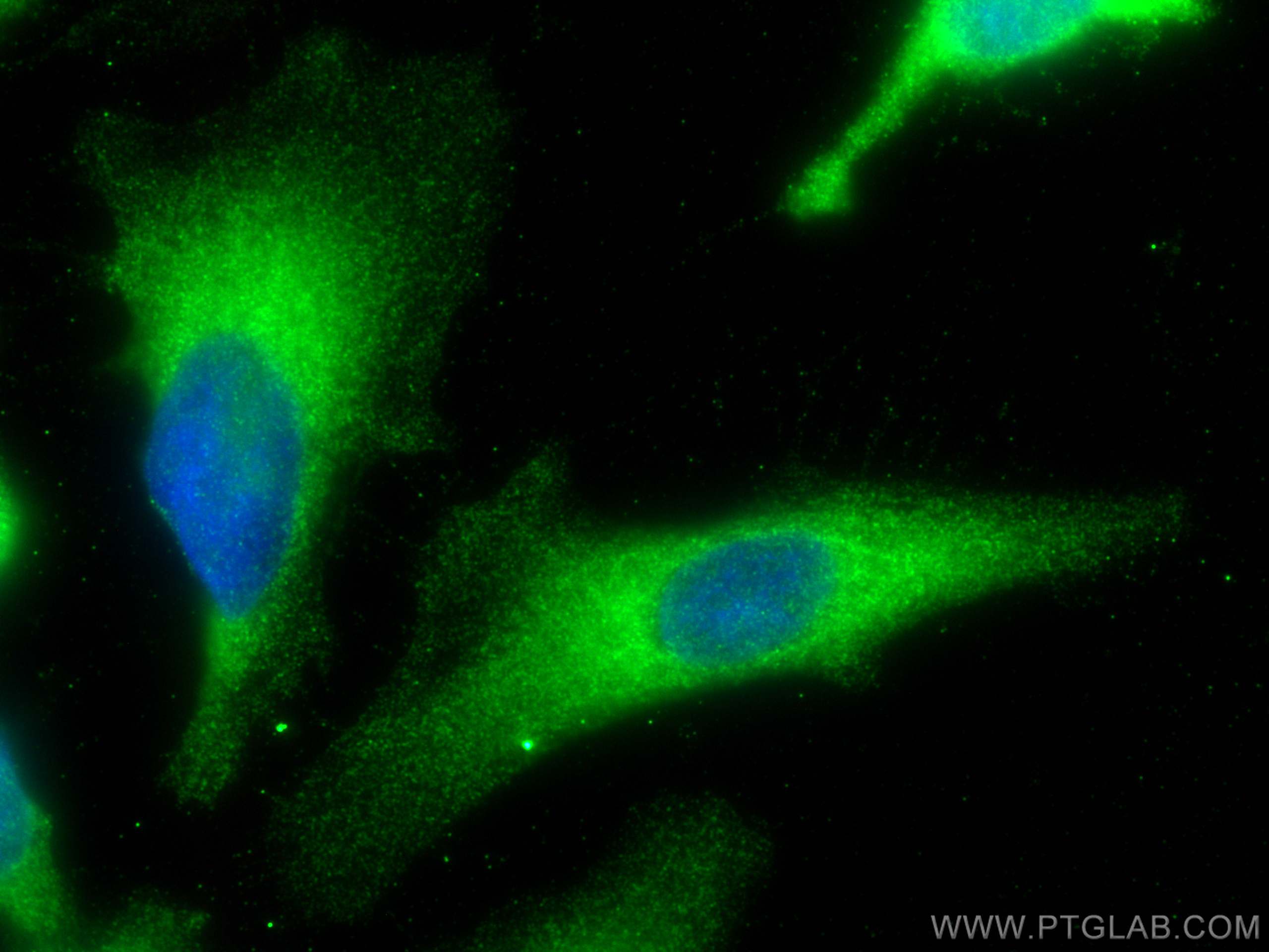 IF Staining of HeLa using 18274-1-AP