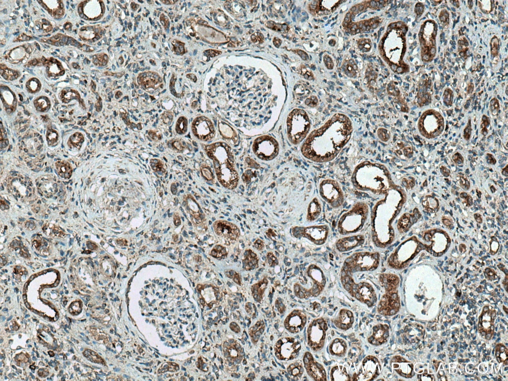Immunohistochemistry (IHC) staining of human kidney tissue using ATP6V0D1 Polyclonal antibody (18274-1-AP)