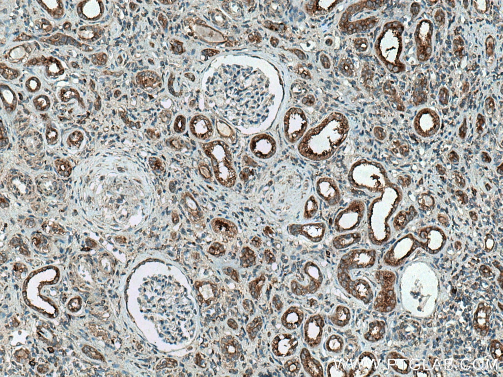 Immunohistochemistry (IHC) staining of human kidney tissue using ATP6V0D1 Polyclonal antibody (18274-1-AP)