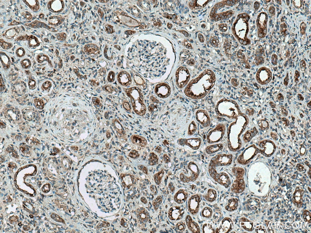 IHC staining of human kidney using 18274-1-AP