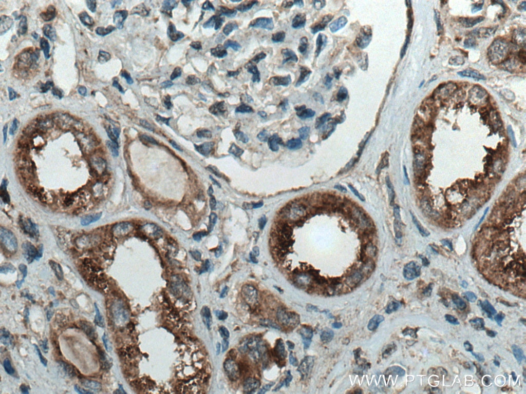 Immunohistochemistry (IHC) staining of human kidney tissue using ATP6V0D1 Polyclonal antibody (18274-1-AP)