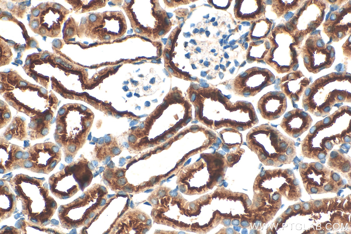Immunohistochemistry (IHC) staining of mouse kidney tissue using ATP6V0D1 Polyclonal antibody (18274-1-AP)