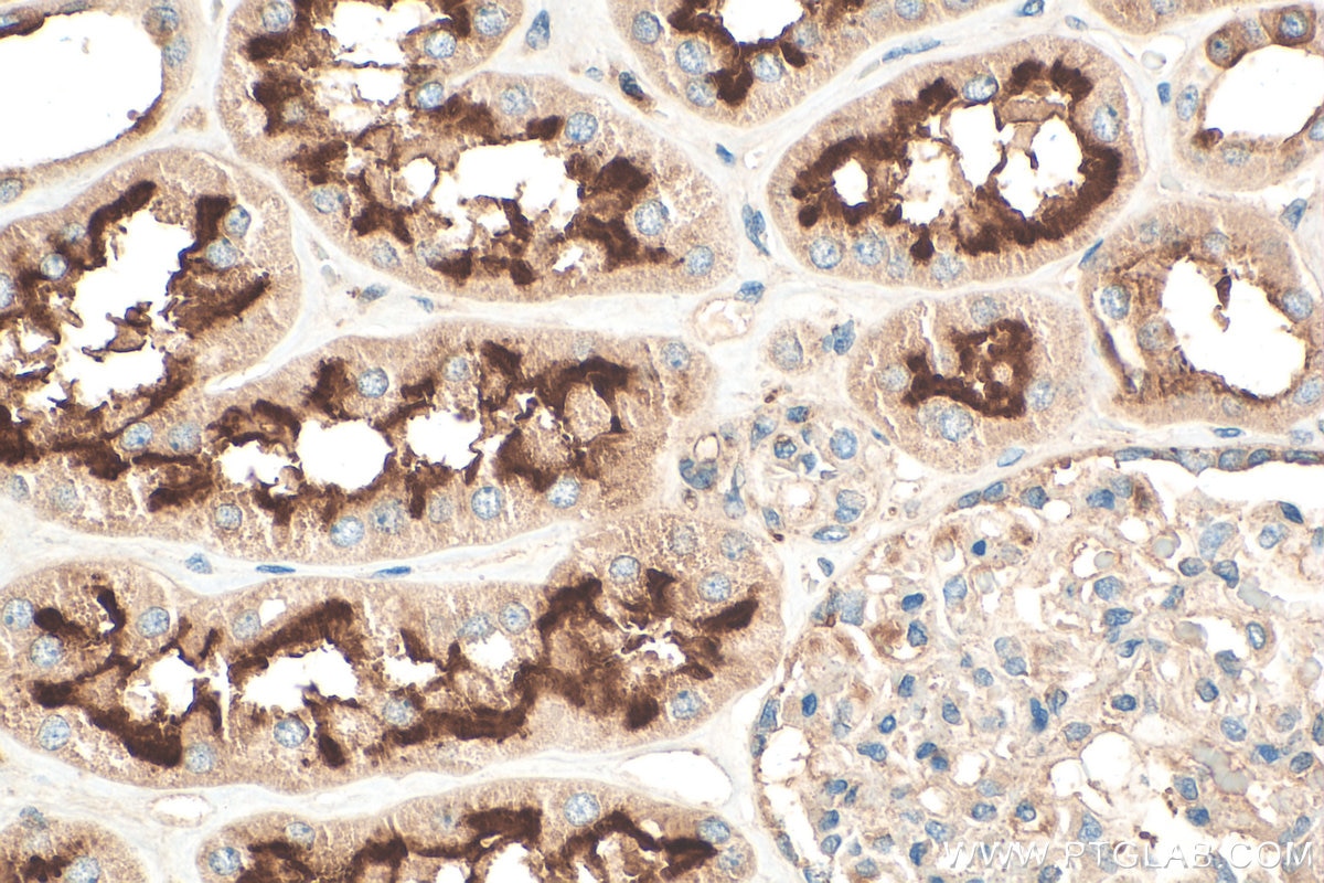 Immunohistochemistry (IHC) staining of human kidney tissue using ATP6V0D1 Polyclonal antibody (18274-1-AP)