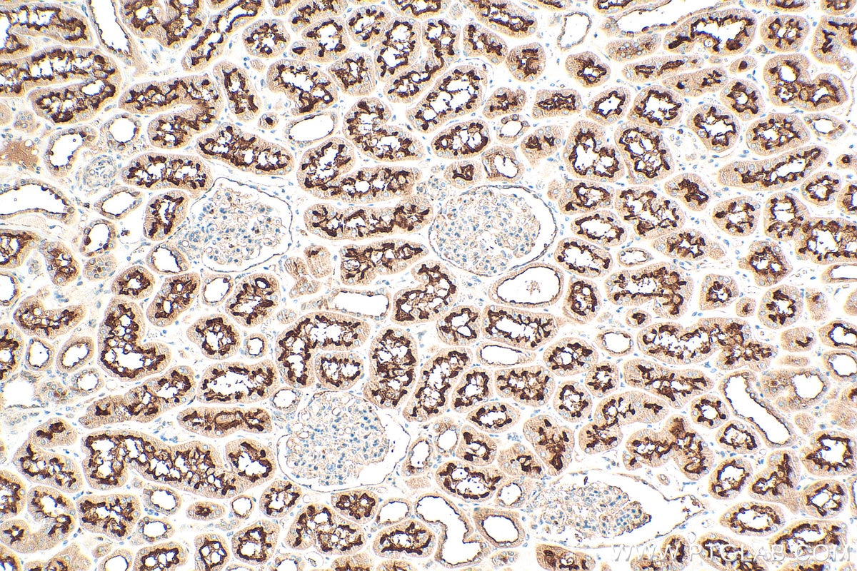 Immunohistochemistry (IHC) staining of human kidney tissue using ATP6V0D1 Polyclonal antibody (18274-1-AP)