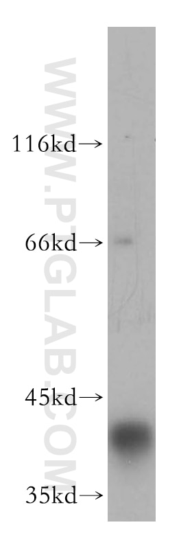 Western Blot (WB) analysis of human placenta tissue using ATP6V0D1 Polyclonal antibody (18274-1-AP)