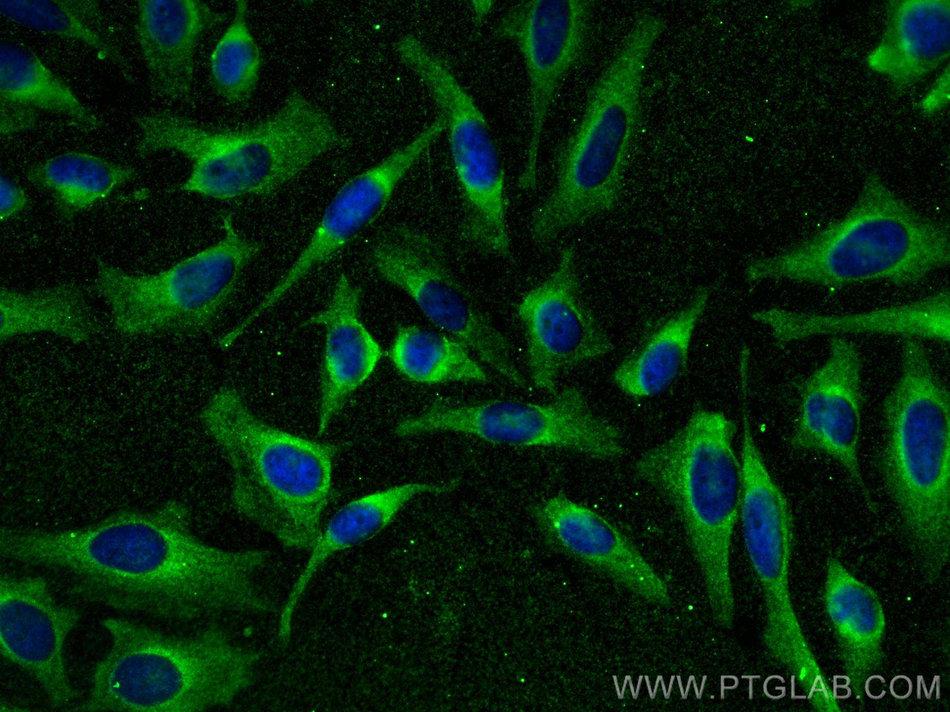 Immunofluorescence (IF) / fluorescent staining of HeLa cells using ATP6V0D1 Monoclonal antibody (68506-1-Ig)