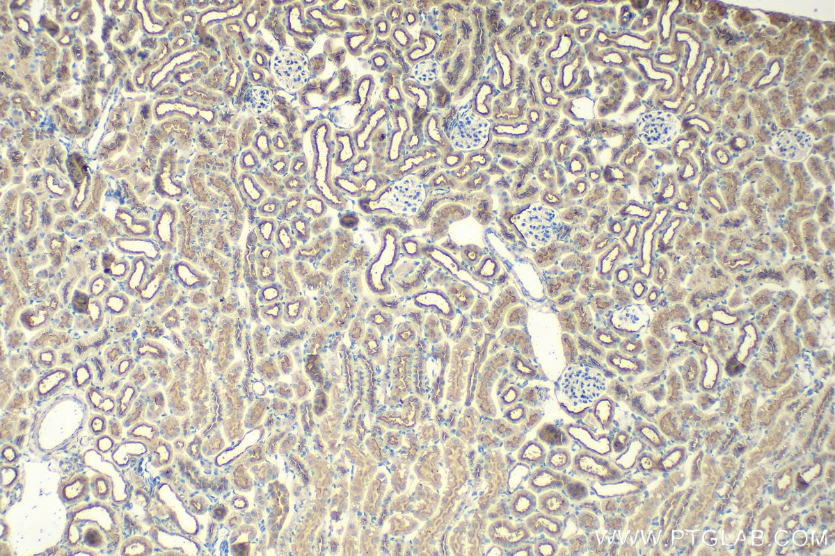 Immunohistochemistry (IHC) staining of mouse kidney tissue using ATP6V0D1 Monoclonal antibody (68506-1-Ig)