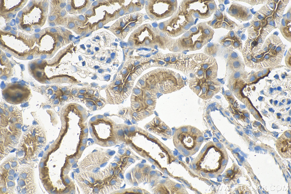 Immunohistochemistry (IHC) staining of mouse kidney tissue using ATP6V0D1 Monoclonal antibody (68506-1-Ig)