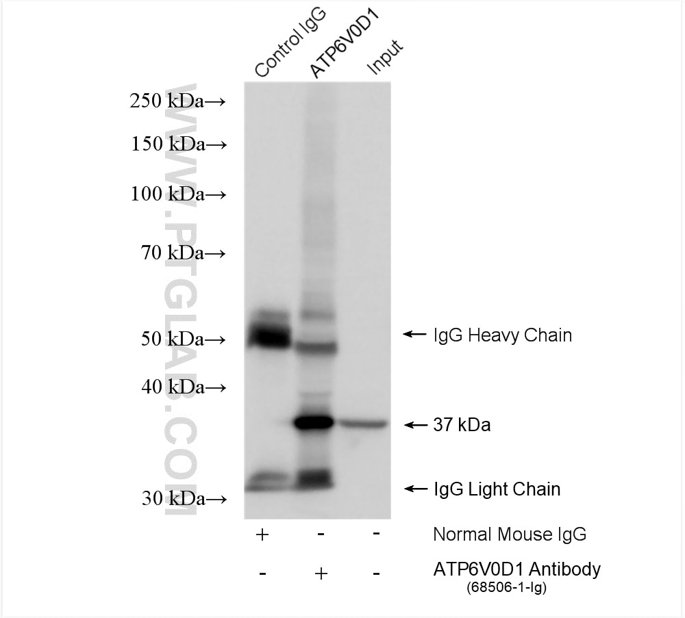 Immunoprecipitation (IP) experiment of HeLa cells using ATP6V0D1 Monoclonal antibody (68506-1-Ig)