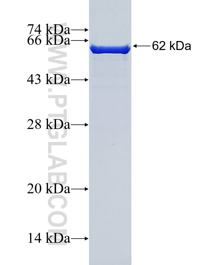 ATP6V0D1 fusion protein Ag13002 SDS-PAGE