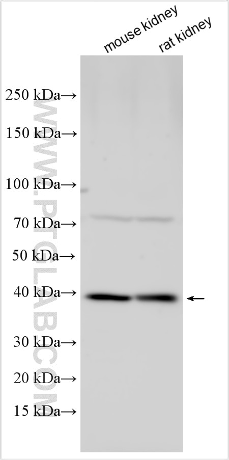 Various lysates were subjected to SDS PAGE followed by western blot with 33364-1-AP (ATP6V0D2 antibody) at dilution of 1:1000 incubated at room temperature for 1.5 hours. Western Blot (WB) analysis of various lysates using ATP6V0D2 Polyclonal antibody (33364-1-AP)