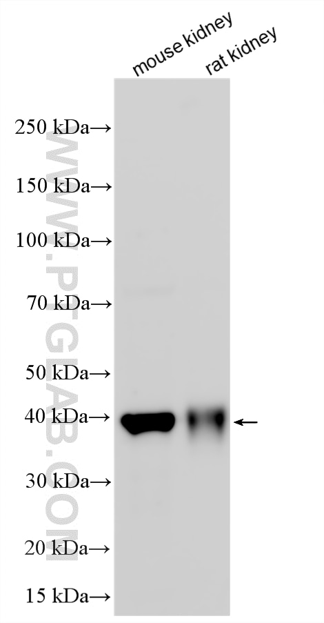 WB analysis using 33364-1-AP (same clone as 33364-1-PBS) Western Blot (WB) analysis of various lysates using ATP6V0D2 Polyclonal antibody (33364-1-AP)