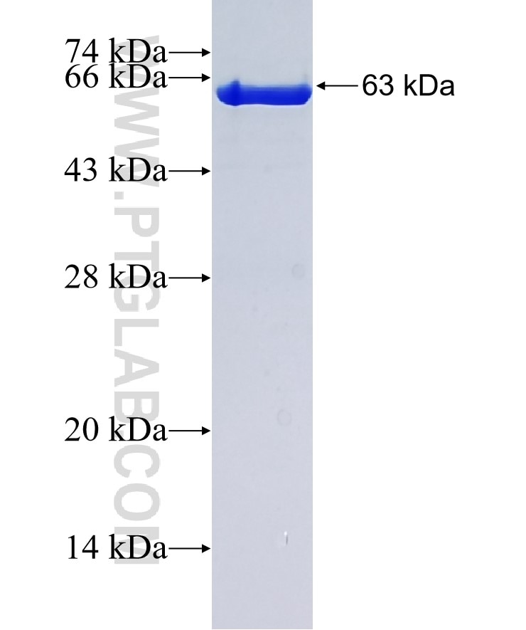 ATP6V0D2 fusion protein Ag5879 SDS-PAGE