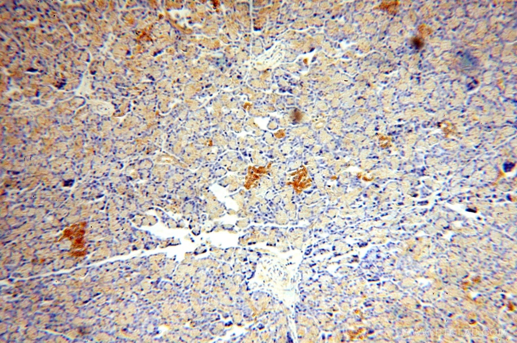 Immunohistochemistry (IHC) staining of human pancreas tissue using ATP6V1A Polyclonal antibody (17115-1-AP)