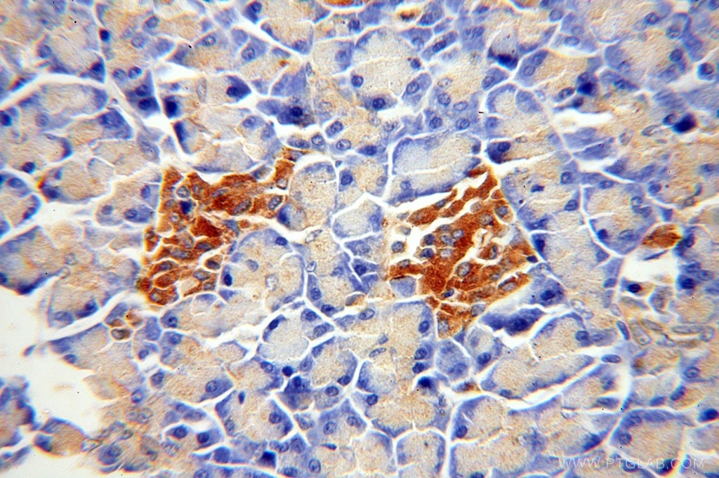 Immunohistochemistry (IHC) staining of human pancreas tissue using ATP6V1A Polyclonal antibody (17115-1-AP)