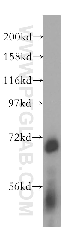 ATP6V1A