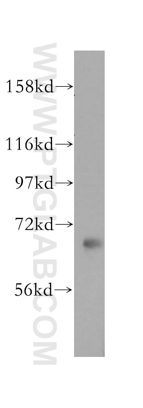 Western Blot (WB) analysis of human placenta tissue using ATP6V1A Polyclonal antibody (17115-1-AP)
