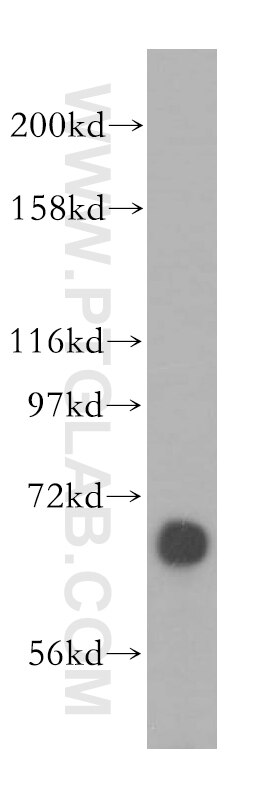 Western Blot (WB) analysis of mouse kidney tissue using ATP6V1A Polyclonal antibody (17115-1-AP)