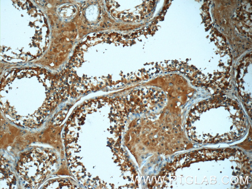 Immunohistochemistry (IHC) staining of human testis tissue using ATP6V1A Polyclonal antibody (51152-1-AP)