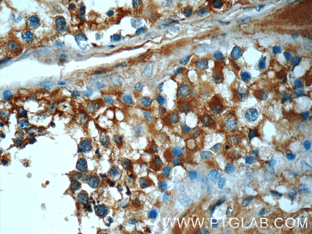 Immunohistochemistry (IHC) staining of human testis tissue using ATP6V1A Polyclonal antibody (51152-1-AP)