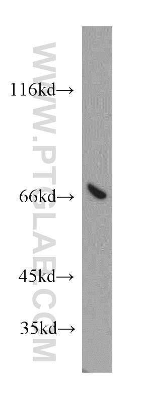 Western Blot (WB) analysis of HeLa cells using ATP6V1A Polyclonal antibody (51152-1-AP)