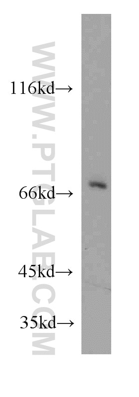 Western Blot (WB) analysis of HeLa cells using ATP6V1A Polyclonal antibody (51152-1-AP)