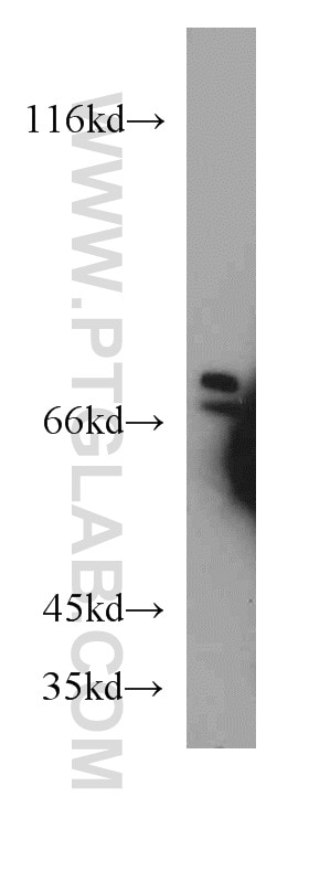 Western Blot (WB) analysis of HEK-293 cells using ATP6V1A Polyclonal antibody (51152-1-AP)