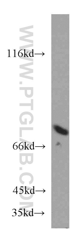 Western Blot (WB) analysis of human brain tissue using ATP6V1A Polyclonal antibody (51152-1-AP)