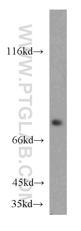 Western Blot (WB) analysis of human brain tissue using ATP6V1A Polyclonal antibody (51152-1-AP)
