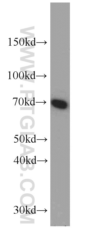 Western Blot (WB) analysis of mouse kidney tissue using ATP6V1A Polyclonal antibody (51152-1-AP)