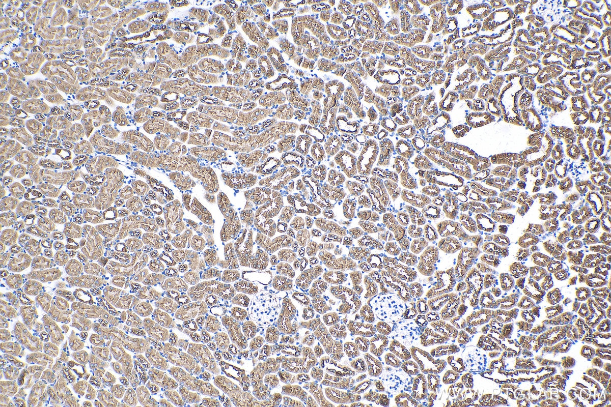 Immunohistochemistry (IHC) staining of mouse kidney tissue using ATP6V1A Monoclonal antibody (68440-1-Ig)