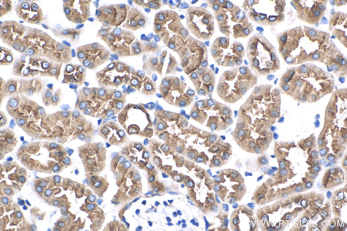 Immunohistochemistry (IHC) staining of mouse kidney tissue using ATP6V1A Monoclonal antibody (68440-1-Ig)