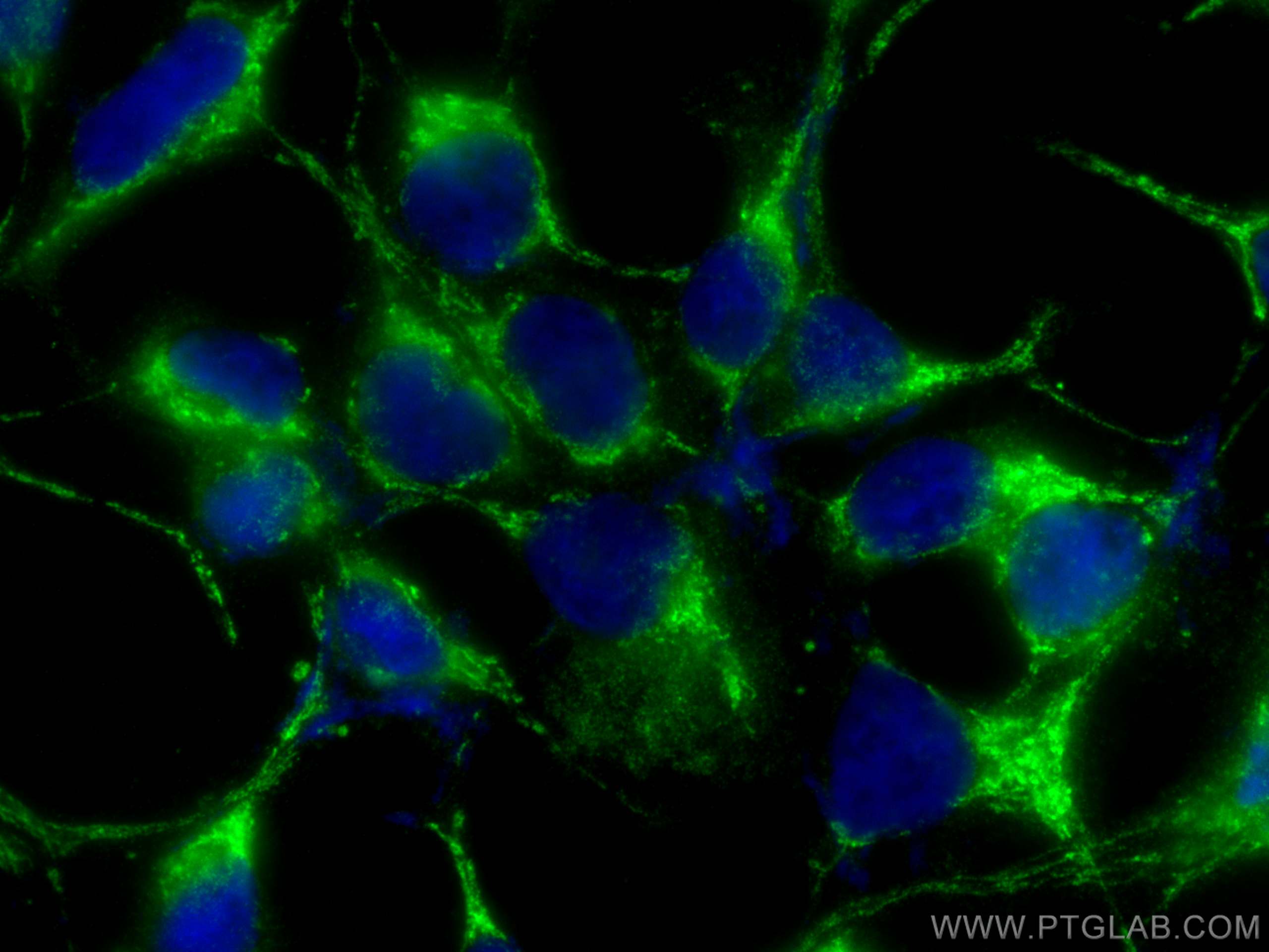 Immunofluorescence (IF) / fluorescent staining of HEK-293 cells using ATP6V1B1 Polyclonal antibody (14780-1-AP)