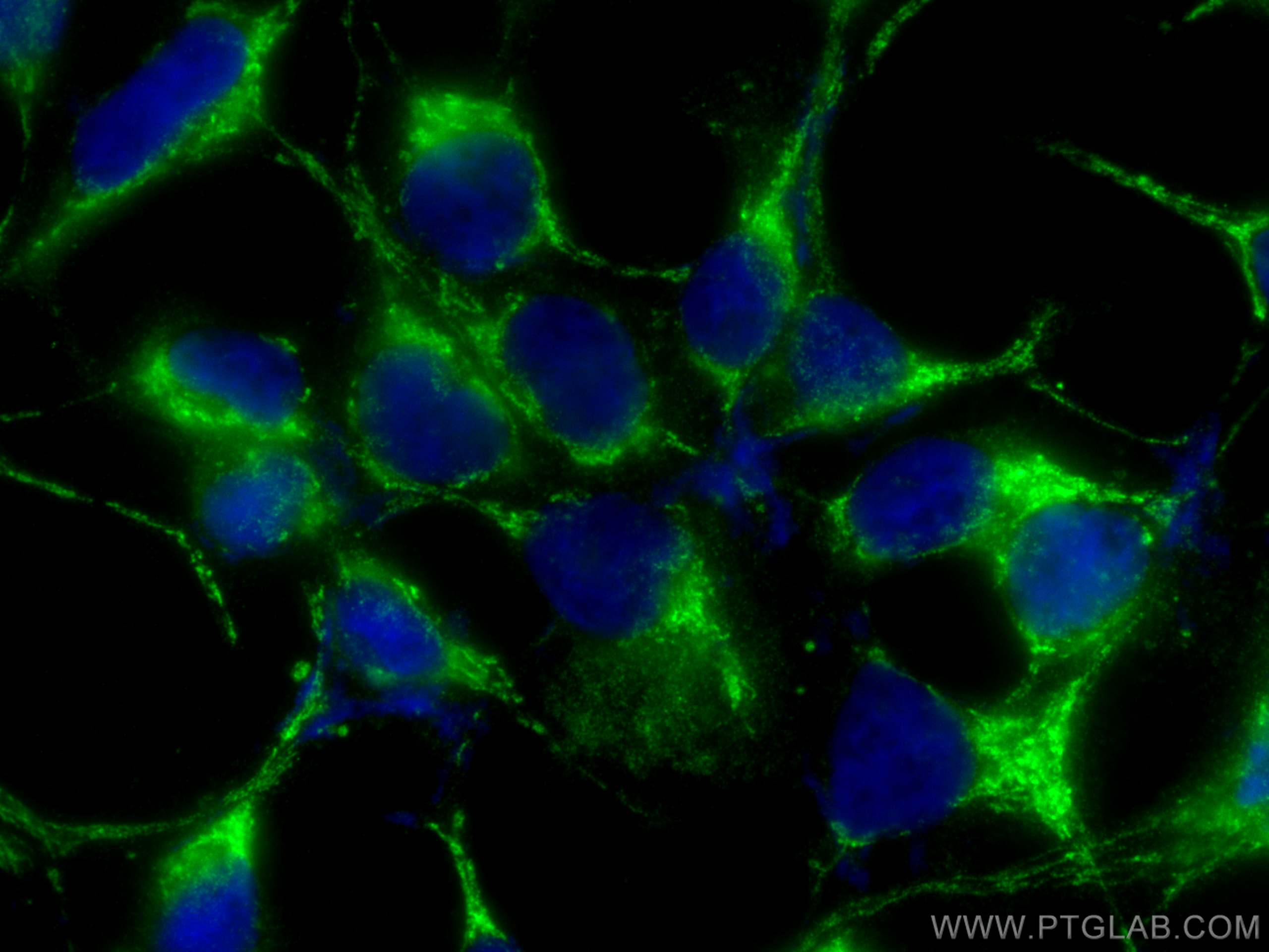 IF Staining of HEK-293 using 14780-1-AP