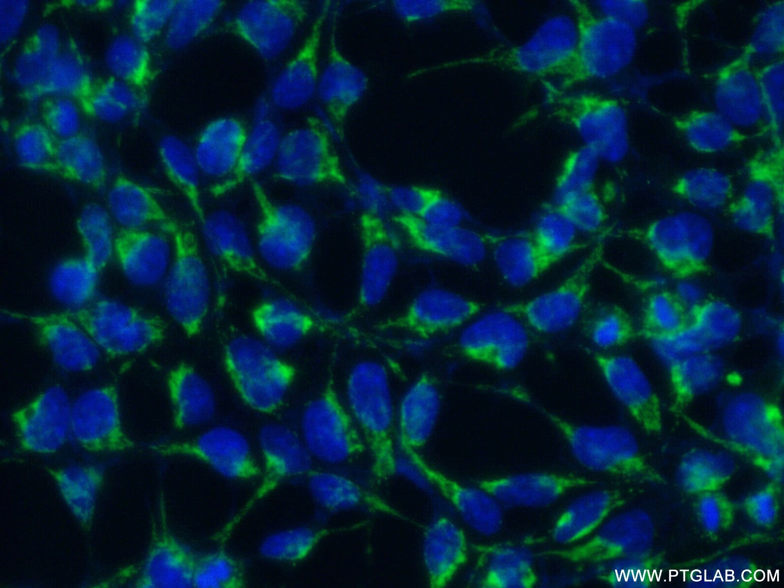 Immunofluorescence (IF) / fluorescent staining of HEK-293 cells using ATP6V1B1 Polyclonal antibody (14780-1-AP)