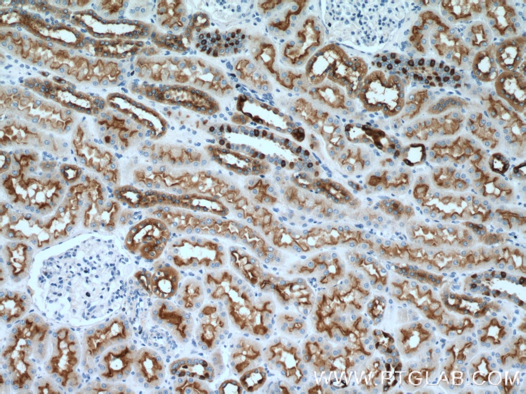 Immunohistochemistry (IHC) staining of human kidney tissue using ATP6V1B1 Polyclonal antibody (14780-1-AP)