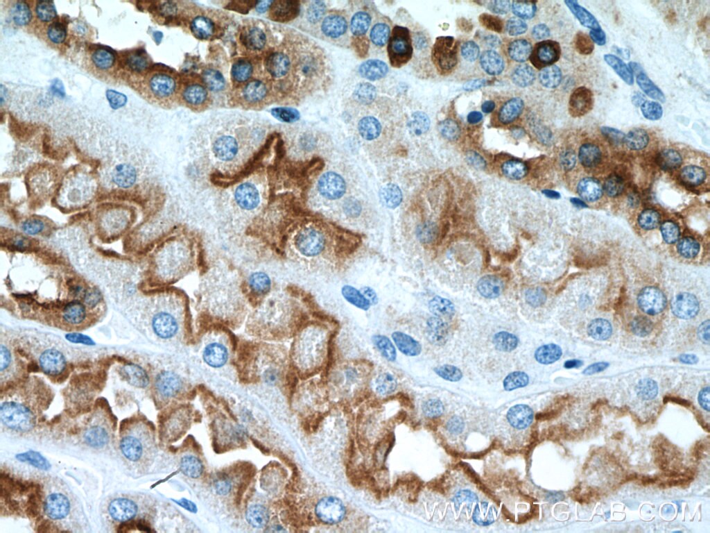 Immunohistochemistry (IHC) staining of human kidney tissue using ATP6V1B1 Polyclonal antibody (14780-1-AP)