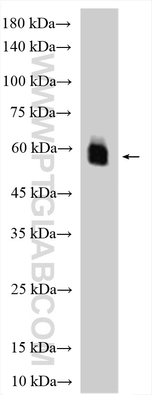 Western Blot (WB) analysis of mouse kidney tissue using ATP6V1B1 Polyclonal antibody (14780-1-AP)