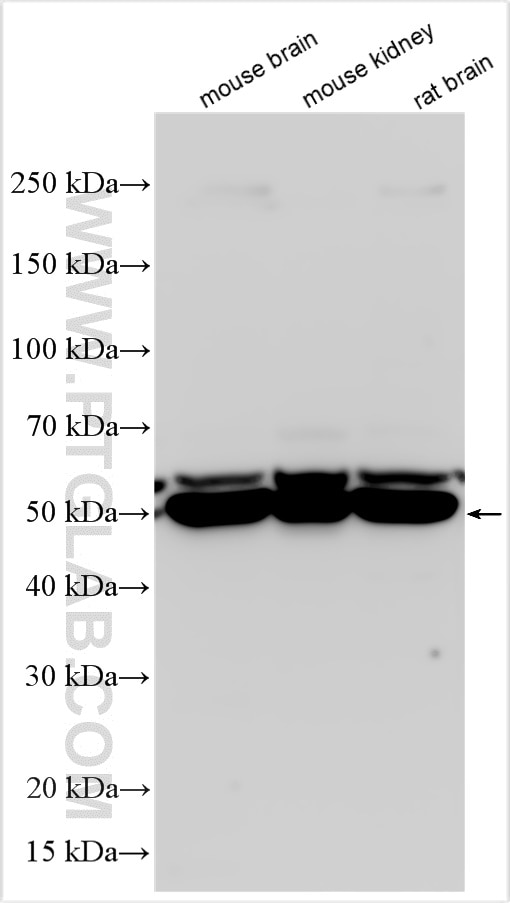 Western Blot (WB) analysis of various lysates using ATP6V1B1 Polyclonal antibody (14780-1-AP)