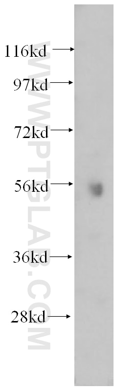 Western Blot (WB) analysis of human brain tissue using ATP6V1B1 Polyclonal antibody (14780-1-AP)